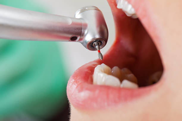Best Pediatric Emergency Dentist in Leisure City, FL